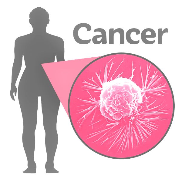 silhouette of a body with the word 'cancer' next to it